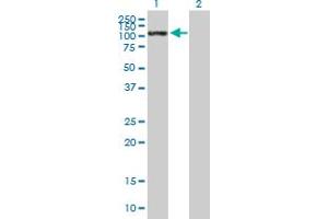 Western Blot analysis of SELE expression in transfected 293T cell line by SELE MaxPab polyclonal antibody. (Selectin E/CD62e antibody  (AA 1-610))