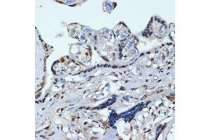 Immunohistochemistry of paraffin-embedded human placenta using HOX Rabbit mAb (ABIN7267764) at dilution of 1:100 (40x lens). (HOXA9 antibody)
