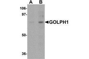 Western blot analysis of GOLPH1 in K562 cell lysate with AP30370PU-N GOLPH1 antibody at (A) 1 and (B) 2 μg/ml. (ACBD3 antibody  (N-Term))