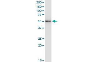 ENO1 monoclonal antibody (M07A), clone 8G3. (ENO1 antibody  (AA 1-434))