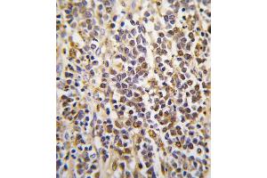 Formalin-fixed and paraffin-embedded human kidney tissue reacted with ALDH1A3 Antibody (Center), which was peroxidase-conjugated to the secondary antibody, followed by DAB staining. (ALDH1A3 antibody  (AA 318-348))