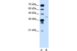 Western Blotting (WB) image for anti-Microfibrillar-Associated Protein 3-Like (MFAP3L) antibody (ABIN2463967)