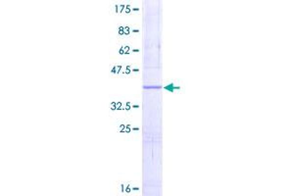 NDUFS5 Protein (AA 1-106) (GST tag)