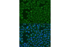 Immunofluorescence analysis of U2OS cells using FMO5 antibody (ABIN6133516, ABIN6140714, ABIN6140715 and ABIN6223596) at dilution of 1:100. (FMO5 antibody  (AA 1-285))