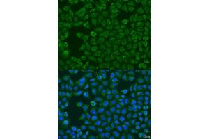 Immunofluorescence analysis of U2OS cells using FMO5 antibody (ABIN6133516, ABIN6140714, ABIN6140715 and ABIN6223596) at dilution of 1:100. (FMO5 antibody  (AA 1-285))