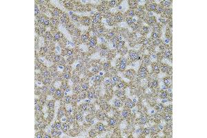 Immunohistochemistry of paraffin-embedded rat liver using ALDH1A1 antibody (ABIN5970911) at dilution of 1/100 (40x lens). (ALDH1A1 antibody)