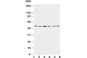 Western blot testing of Presenilin 2 antibody and Lane 1:  rat brain;  2: rat brain;  3: MCF-7; 4: HeLa;  5: SMMC-7721;  6: CEM