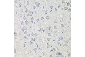 Immunohistochemistry of paraffin-embedded mouse brain using CD97 antibody (ABIN5971965) at dilution of 1/100 (40x lens). (CD97 antibody)