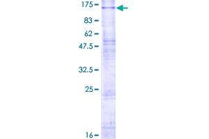 CLCN6 Protein (AA 1-869) (GST tag)