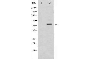 Western blot analysis of Smad1 phosphorylation expression in Mouse muscletissue lysates,The lane on the left is treated with the antigen-specific peptide. (SMAD1 antibody  (pSer187))