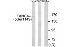 Western blot analysis of extracts from HeLa cells treated with IGF 100ng/ml 10' and HuvEc cells treated with EGF 200ng/ml 30', using FANCA (Phospho-Ser1149) Antibody. (FANCA antibody  (pSer1149))