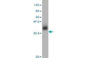 Western Blot detection against Immunogen (37. (ZNF41 antibody  (AA 221-321))
