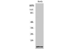 Western Blotting (WB) image for anti-Diazepam Binding Inhibitor (DBI) (Internal Region) antibody (ABIN3183140) (Diazepam Binding Inhibitor antibody  (Internal Region))