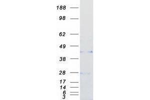 Western Blotting (WB) image for WNT1 Inducible Signaling Pathway Protein 2 (WISP2) protein (Myc-DYKDDDDK Tag) (ABIN2735601)
