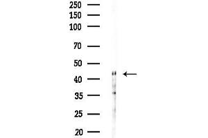 anti-Carbohydrate (N-Acetylgalactosamine 4-0) Sulfotransferase 14 (CHST14) (Internal Region) antibody