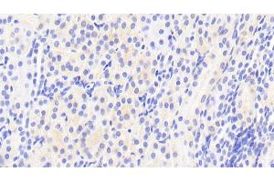 Detection of AFM in Human Kidney Tissue using Polyclonal Antibody to Afamin (AFM) (Afamin antibody  (AA 22-210))