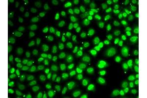 Immunofluorescence analysis of A549 cells using XPO5 antibody (ABIN5974114). (XPO5 antibody)