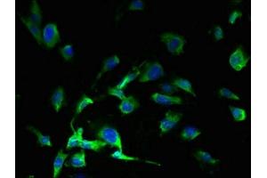 Immunofluorescent analysis of U251 cells using ABIN7166779 at dilution of 1:100 and Alexa Fluor 488-congugated AffiniPure Goat Anti-Rabbit IgG(H+L) (Solute Carrier Family 38, Member 7 (SLC38A7) (AA 1-55) antibody)