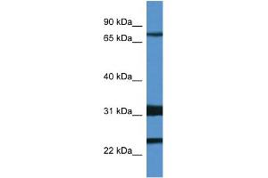 WB Suggested Anti-Kcnd1 Antibody   Titration: 1. (KCND1 antibody  (N-Term))