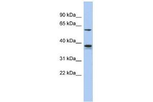 GOPC antibody used at 1 ug/ml to detect target protein. (GOPC antibody  (Middle Region))