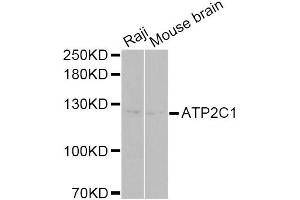 Western blot analysis of extracts of various cell lines, using ATP2C1 Antibody (ABIN5975353) at 1/1000 dilution.