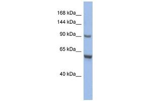 WB Suggested Anti-CIZ1 Antibody Titration:  0. (CIZ1 antibody  (Middle Region))