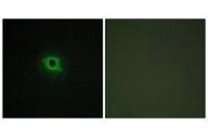 Immunofluorescence analysis of COS-7 cells, using DGKK antibody. (DGKK antibody  (C-Term))