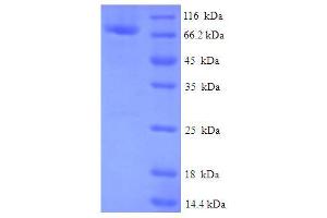 FAM114A2 Protein (AA 1-505, full length) (His-SUMO Tag)