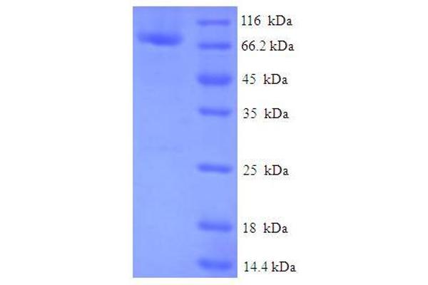 FAM114A2 Protein (AA 1-505, full length) (His-SUMO Tag)