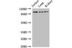 Western Blot Positive WB detected in: Jurkat whole cell lysate, Mouse lung tissue, Mouse kidney tissue All lanes: SMARCAL1 antibody at 3 μg/mL Secondary Goat polyclonal to rabbit IgG at 1/50000 dilution Predicted band size: 106 kDa Observed band size: 106 kDa (SMARCAL1 antibody  (AA 6-277))