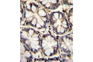 Immunohistochemistry (Paraffin-embedded Sections) (IHC (p)) image for anti-Tumor Necrosis Factor Receptor Superfamily, Member 1A (TNFRSF1A) (AA 24-52), (N-Term) antibody (ABIN951180)