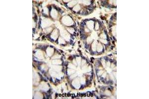 TNFRSF1A Antibody (N-term) immunohistochemistry analysis in formalin fixed and paraffin embedded human rectum tissue followed by peroxidase conjugation of the secondary antibody and DAB staining. (TNFRSF1A antibody  (N-Term))