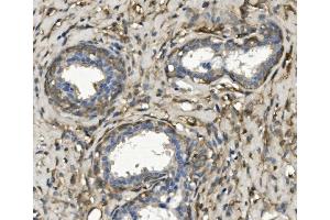 IHC analysis of non-muscle Myosin IIB/MYH10 using anti-non-muscle Myosin IIB/MYH10 antibody (ABIN7603186).