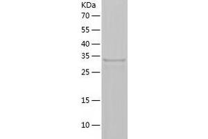 Western Blotting (WB) image for Hydroxysteroid (17-Beta) Dehydrogenase 14 (HSD17B14) (AA 1-306) protein (His tag) (ABIN7288534) (HSD17B14 Protein (AA 1-306) (His tag))