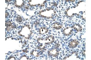 Ankyrin 1 antibody was used for immunohistochemistry at a concentration of 4-8 ug/ml to stain Alveolar cells (arrows) in Human Lung. (Erythrocyte Ankyrin antibody  (C-Term))