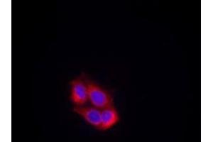 Image no. 1 for anti-VEGF Receptor 2 (VEGFR2) (AA 949-953) antibody (ABIN197240) (VEGFR2/CD309 antibody  (AA 949-953))