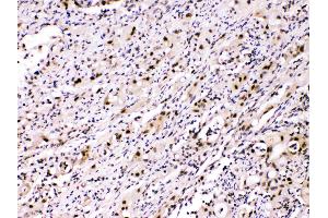IHC analysis of ATP citrate lyase using anti- ATP citrate lyase antibody . (ACLY antibody  (AA 1-180))
