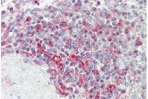 Human Spleen: Formalin-Fixed, Paraffin-Embedded (FFPE) (CLK4 antibody  (AA 101-150))