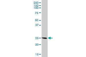 FKBP14 MaxPab polyclonal antibody. (FKBP14 antibody  (AA 1-211))