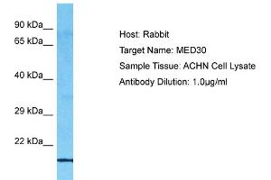 Host: Rabbit Target Name: MED30 Sample Type: ACHN Whole Cell lysates Antibody Dilution: 1.