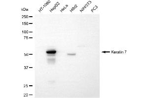 Western blotting analysis using keratin 7 antibody (ABIN7799188). (Recombinant Cytokeratin 7 antibody)