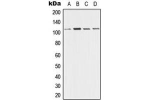 Western blot analysis of Desmoglein 3 expression in A431 (A), HeLa (B), Raw264. (Desmoglein 3 antibody  (Center))
