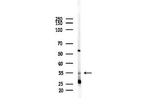 anti-Uridine-Cytidine Kinase 2 (UCK2) (C-Term) antibody