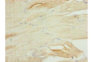 Immunohistochemistry of paraffin-embedded human skeletal muscle tissue using ABIN7167180 at dilution of 1:100 (Rasl10b antibody  (AA 15-200))