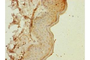 Immunohistochemistry of paraffin-embedded human skin tissue using ABIN7160531 at dilution of 1:100 (MYL1 antibody  (AA 1-150))