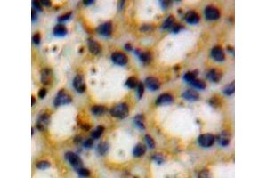 Used in DAB staining on fromalin fixed paraffin-embedded Kidney tissue (Thyroperoxidase antibody  (AA 636-832))