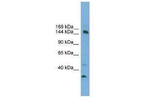 MED14 antibody used at 0. (MED14 antibody  (Middle Region))