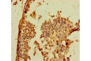 Immunohistochemistry of paraffin-embedded human testis tissue using ABIN7164461 at dilution of 1:100 (GPR156 antibody  (AA 614-814))