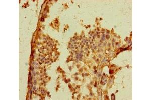 Immunohistochemistry of paraffin-embedded human testis tissue using ABIN7164461 at dilution of 1:100