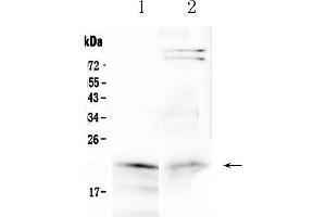 Western blot analysis of Cytoglobin using anti-Cytoglobin antibody . (CYGB antibody  (AA 1-190))